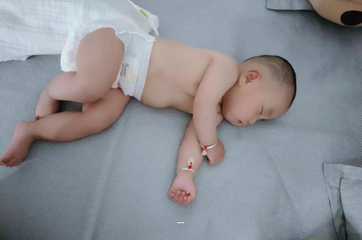 塔城宝宝脸上有白色斑块